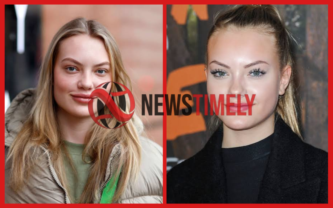 Cheyenne Ochsenknecht Lippen: Was wirklich passiert ist Cheyenne Ochsenknecht Lippen